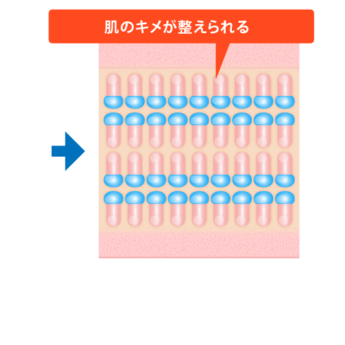 N トレチノインシリーズ処方 トレチノインカプセル製剤 ホームケア 美容整形 美容外科 美容皮膚科なら聖心美容クリニック