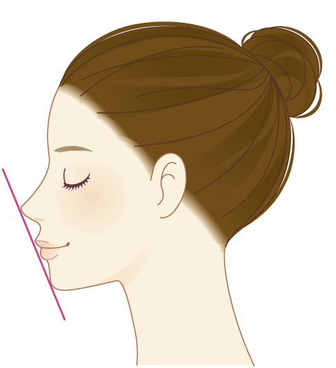 鼻尖縮小 団子鼻修正 鼻の整形 美容整形 美容外科 美容皮膚科なら聖心美容クリニック