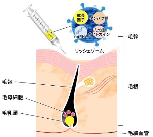 Richexosome リッシェゾーム 美容整形 美容外科 美容皮膚科なら聖心美容クリニック