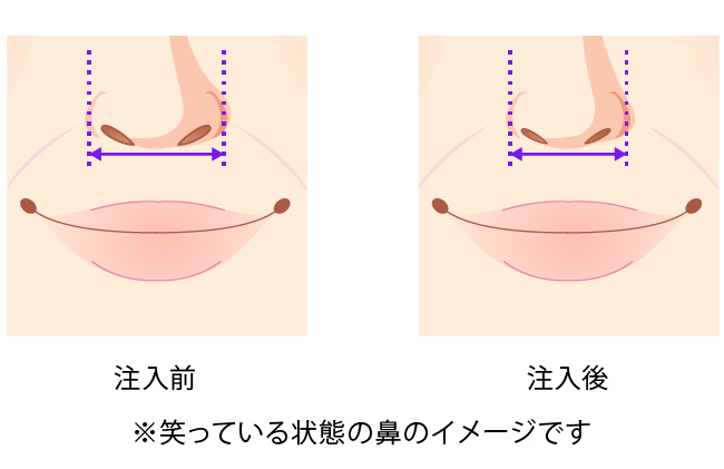 正面から見る変化