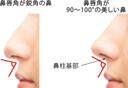 Point.2 鼻柱と人中で作られる角度（鼻唇角）