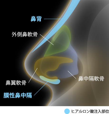 危険な部位への注入を回避するために