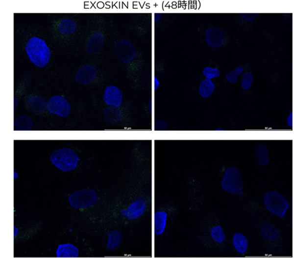 EXOSKIN EVs（48時間）